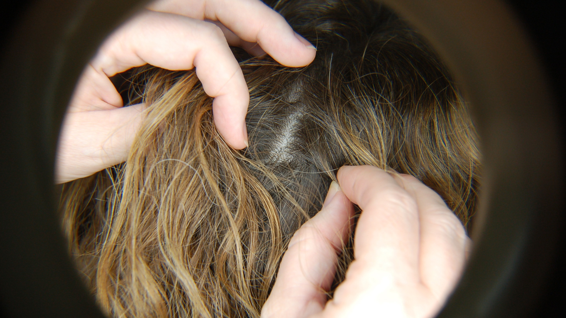 Riverside Health Centre Head Lice Riverside Health Centre